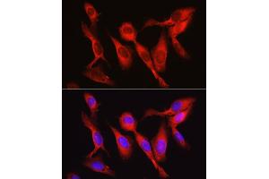 Immunofluorescence analysis of U2OS cells using Vinculin antibody (ABIN6128911, ABIN6150070, ABIN6150071 and ABIN6218474) at dilution of 1:150. (Vinculin 抗体  (AA 767-1066))