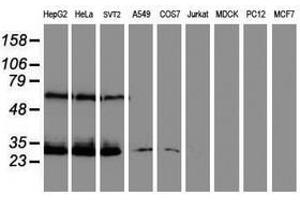 Image no. 2 for anti-Centromere Protein H (CENPH) antibody (ABIN1497470) (CENPH 抗体)