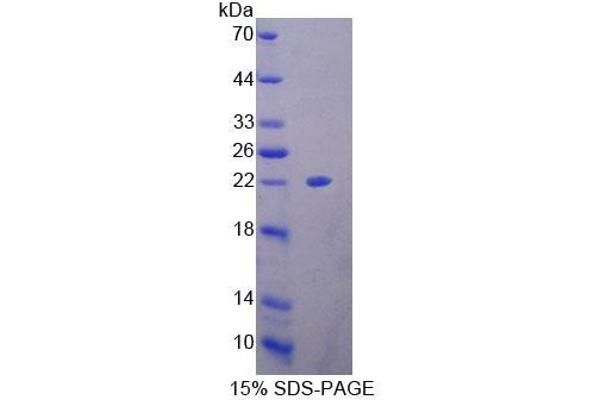 HMGB4 Protein (AA 25-167) (T7 tag,His tag)