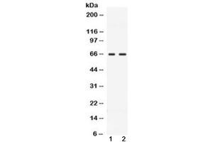 Western blot testing of 1) rat testis and 2) human MCF7 lysate with CCDC6 antibody at 0. (CCDC6 抗体  (AA 156-198))