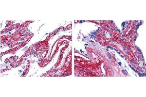 anti collagen V antibody (600-401-107 Lot 22063, 1:200, 45 min RT) showed strong staining in FFPE sections of human lung (left) with strong staining within alveoli, vessels, and in connective tissue spaces; and placenta (right) with strong staining observed in stromal and connective tissue spaces and vessel walls.