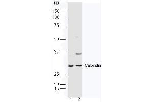 Lane1: Mouse kidney lysate, Lane2: Mouse brain lysate probed with Rabbit Anti-Calbindin Polyclonal Antibody, Unconjugated (ABIN2559729) at 1:300 in 4˚C. (CALB1 抗体  (AA 41-150))