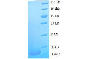 Macrophage Migration Inhibitory Factor (Glycosylation-Inhibiting Factor) (MIF) (AA 2-115), (full length) protein (His tag)