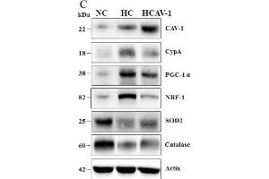 CAV-1 preserves mitochondrial respiratory function through regulation of OXPHOS expression.