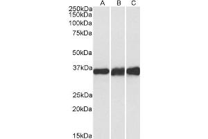 Western Blotting (WB) image for anti-Lactate Dehydrogenase B (LDHB) antibody (ABIN5870352) (LDHB 抗体)