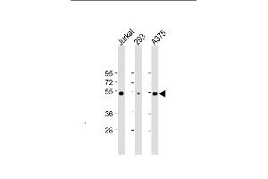 All lanes : Anti-RBCK1 (UBCE7IP3) Antibody at 1:2000 dilution Lane 1: Jurkat whole cell lysate Lane 2: 293 whole cell lysate Lane 3:  whole cell lysate Lysates/proteins at 20 μg per lane. (RBCK1 抗体)
