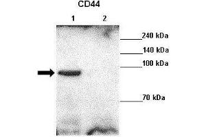Lanes : Lane 1: 10ug MDA-MB-231 lysateLane 2: MDA-MB-231 + CD44 siRNA  Primary Antibody Dilution :  1:1000   Secondary Antibody : Goat anti rabbit-HRP  Secondary Antibody Dilution :  1:10,000  Gene Name : CD44  Submitted by : Chul Geun Kim and Dae Hyun Ha, Hanyang University. (CD44 抗体  (C-Term))