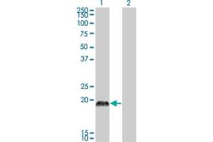 Western Blot analysis of CSRP3 expression in transfected 293T cell line by CSRP3 monoclonal antibody (M03), clone 6D2. (CSRP3 抗体  (AA 95-194))