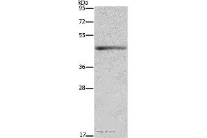 Western blot analysis of Mouse heart tissue, using IL5RA Polyclonal Antibody at dilution of 1:650 (IL5RA 抗体)