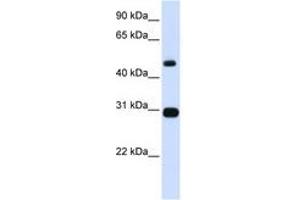 Image no. 1 for anti-Proteasome (Prosome, Macropain) 26S Subunit, ATPase, 3 (PSMC3) (AA 101-134) antibody (ABIN6741431) (PSMC3 抗体  (AA 101-134))