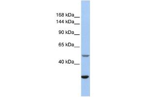 Western Blotting (WB) image for anti-Zinc Finger, ZZ-Type Containing 3 (ZZZ3) antibody (ABIN2459434)