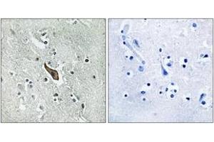 Immunohistochemistry analysis of paraffin-embedded human brain tissue, using ROBO2 Antibody. (ROBO2 抗体  (AA 237-286))
