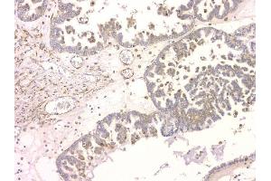 IHC analysis of SRCIN1 using anti-SRCIN1 antibody (ABIN6719623).