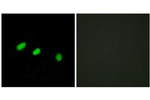 Immunofluorescence analysis of HeLa cells, using TRA-2 alpha antibody. (TRA2A 抗体  (C-Term))