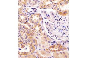 Antibody staining PCCA in human kidney tissue sections by Immunohistochemistry (IHC-P - paraformaldehyde-fixed, paraffin-embedded sections). (PCCA 抗体  (AA 362-390))