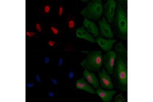 ABIN6257532 and ABIN6275728 staining  cells by IF/ICC.