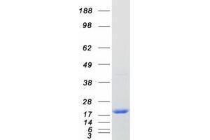 Validation with Western Blot