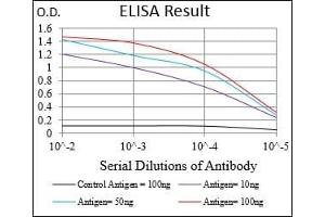 Black line: Control Antigen (100 ng), Purple line: Antigen(10 ng), Blue line: Antigen (50 ng), Red line: Antigen (100 ng), (Retinoblastoma 1 抗体  (AA 2106-2784))