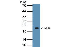 Detection of Recombinant LEP, Canine using Polyclonal Antibody to Leptin (LEP) (Leptin 抗体  (AA 22-167))