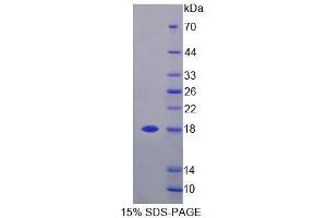 Image no. 1 for Methylmalonyl CoA Epimerase (MCEE) (AA 39-178) protein (His tag) (ABIN6239708) (MCEE Protein (AA 39-178) (His tag))