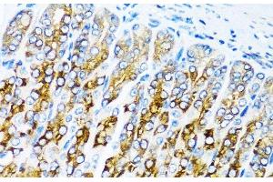Immunohistochemistry of paraffin-embedded Mouse stomach using ACVR1C Polyclonal Antibody at dilution of 1:100 (40x lens).
