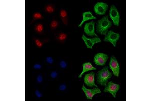 ABIN7094692 and ABIN7098743 staining Hela cells by IF/ICC. (LMX1A 抗体  (Internal Region))