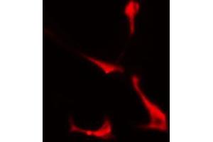 ABIN6274360 staining COLO205 cells by IF/ICC. (PSMD2 抗体  (Internal Region))
