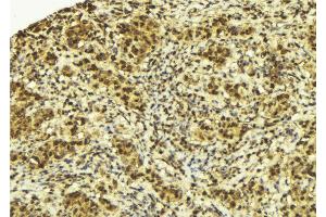 Immunohistochemistry (IHC) image for anti-Speckle-Type POZ Protein (SPOP-B) (Internal Region) antibody (ABIN6265263)