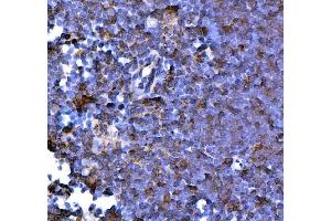 IHC analysis of PD1/Pdcd1 using anti-PD1/Pdcd1 antibody (ABIN7601831). (PD-1 抗体  (AA 48-288))