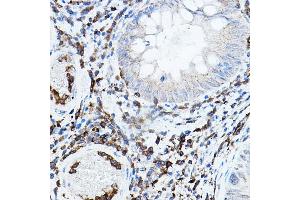 Immunohistochemistry (IHC) image for anti-Protein Kinase C, beta (PRKCB) (AA 1-270) antibody (ABIN6146199)
