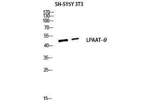 Western Blot (WB) analysis of SH-SY5Y 3T3 lysis using LPAAT-theta antibody. (AGPAT9 抗体  (C-Term))