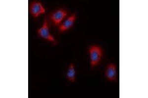 Immunofluorescent analysis of c-RAF staining in HeLa cells.