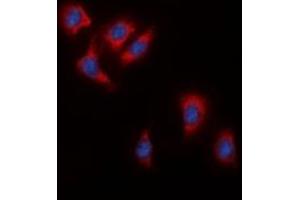 Immunofluorescent analysis of c-RAF staining in HeLa cells. (RAF1 抗体  (C-Term))