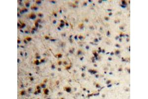 IHC-P analysis of Brain tissue, with DAB staining. (KISS1 抗体  (AA 1-126))