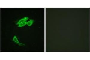 Immunofluorescence analysis of HeLa cells, using PEA-15 (Ab-116) Antibody. (PEA15 抗体  (AA 81-130))