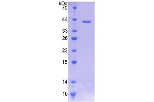 SDS-PAGE analysis of Human CTL1 Protein. (SLC44A1 蛋白)