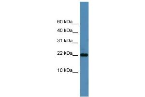 WB Suggested Anti-SFRS12IP1 Antibody Titration: 0. (SFRS12IP1 抗体  (N-Term))