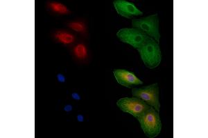 ABIN6258599 and ABIN6274839 staining  cells by IF/ICC.