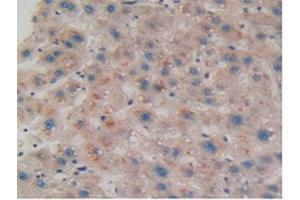 Immunohistochemistry (IHC) image for anti-Coilin (COIL) (AA 319-538) antibody (ABIN7444124)