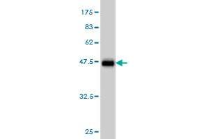Western Blot detection against Immunogen (43. (LMO2 抗体  (AA 1-158))