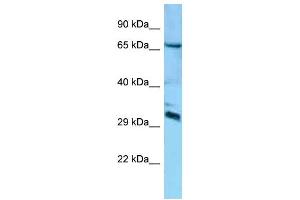 Western Blotting (WB) image for anti-DCN1, Defective in Cullin Neddylation 1, Domain Containing 4 (DCUN1D4) (Middle Region) antibody (ABIN2788475) (DCUN1D4 抗体  (Middle Region))