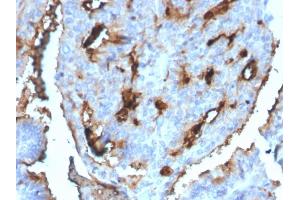 Immunohistochemistry (IHC) image for anti-Cell Division Cycle 34 (CDC34) antibody (ABIN6941292)