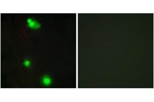Immunofluorescence analysis of MCF7 cells, using SFRS3 Antibody. (SRSF3 抗体  (AA 111-160))