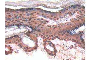 DAB staining on IHC-P; Samples: Rat Skin Tissue (LGALS7 抗体  (AA 1-128))