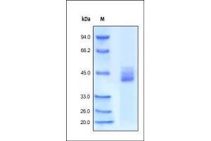 Human CXCR4, Fc Tag on SDS-PAGE under reducing (R) condition. (CXCR4 Protein (AA 1-46) (Fc Tag))