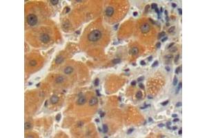Used in DAB staining on fromalin fixed paraffin-embedded liver tissue (GPLD1 抗体  (AA 496-840))