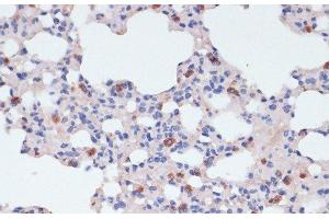 Immunohistochemistry of paraffin-embedded Mouse lung using LYZ Polyclonal Antibody at dilution of 1:100 (40x lens). (LYZ 抗体)