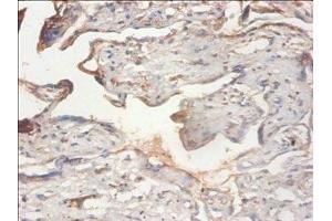 Immunohistochemistry of paraffin-embedded human placenta tissue using ABIN7163064 at dilution of 1:100 (PHF5A 抗体  (AA 1-110))