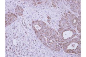 IHC-P Image Immunohistochemical analysis of paraffin-embedded NCI-N87 xenograft, using GALNS, antibody at 1:100 dilution. (GALNS 抗体  (Center))