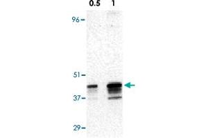 Western blot analysis of RRM2B expression in A-431 cell lysate with RRM2B polyclonal antibody  at 0. (RRM2B 抗体  (AA 2-17))